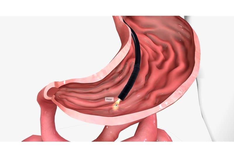 Endoscopia Gastrointestinal