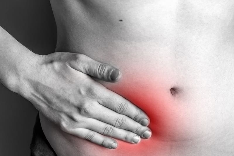 Hernia Inguinal